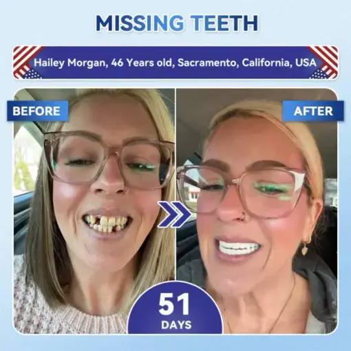 Tideglusib Fast‑Dissolving Tooth & Gum Repair Oral Strips - Image 2