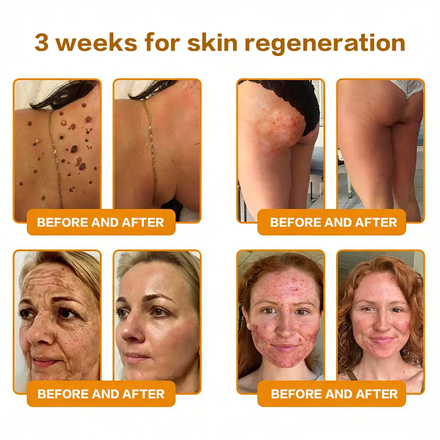 Bee Poison Skin Renewal Cream - Image 10