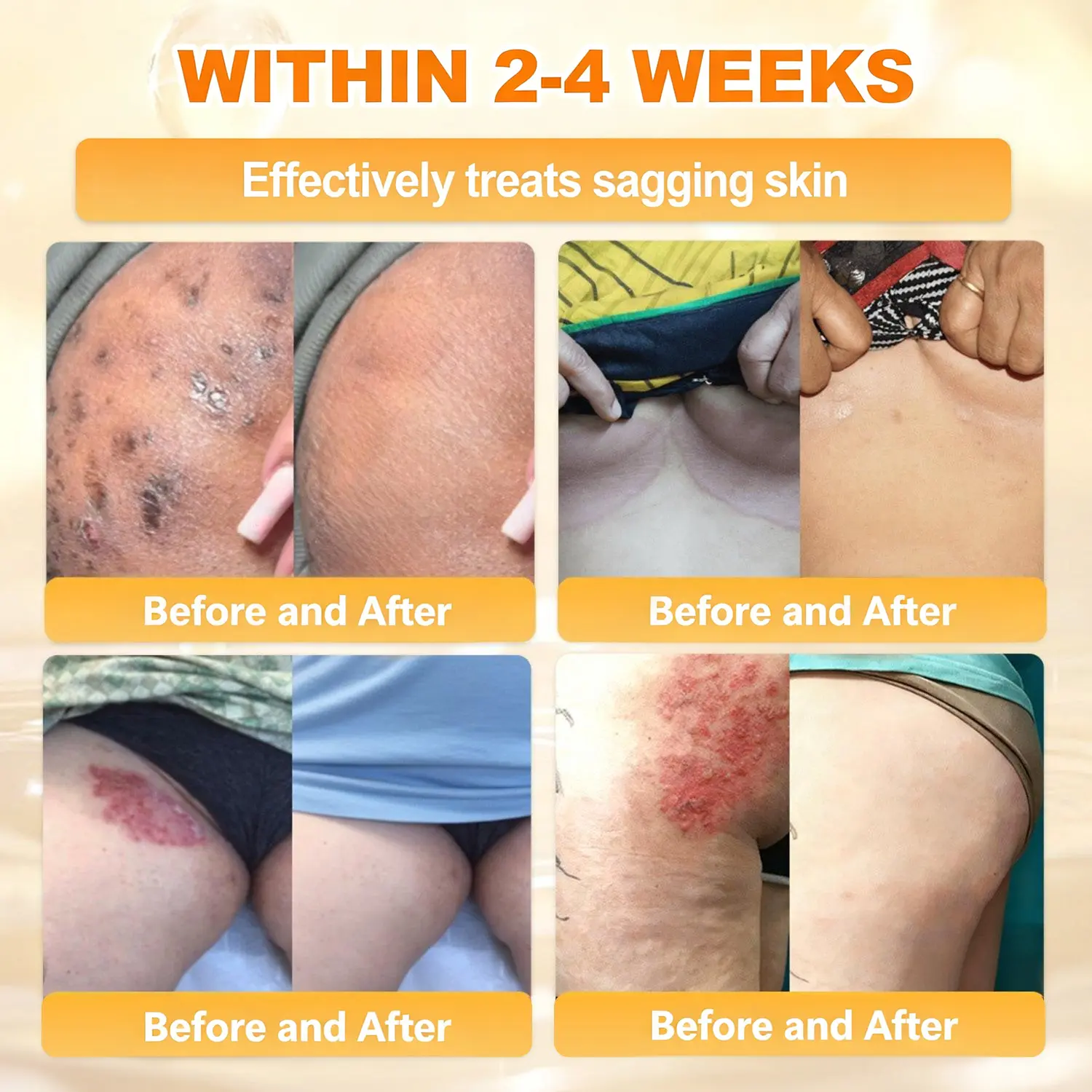 Bee Poison Skin Renewal Cream - Image 6