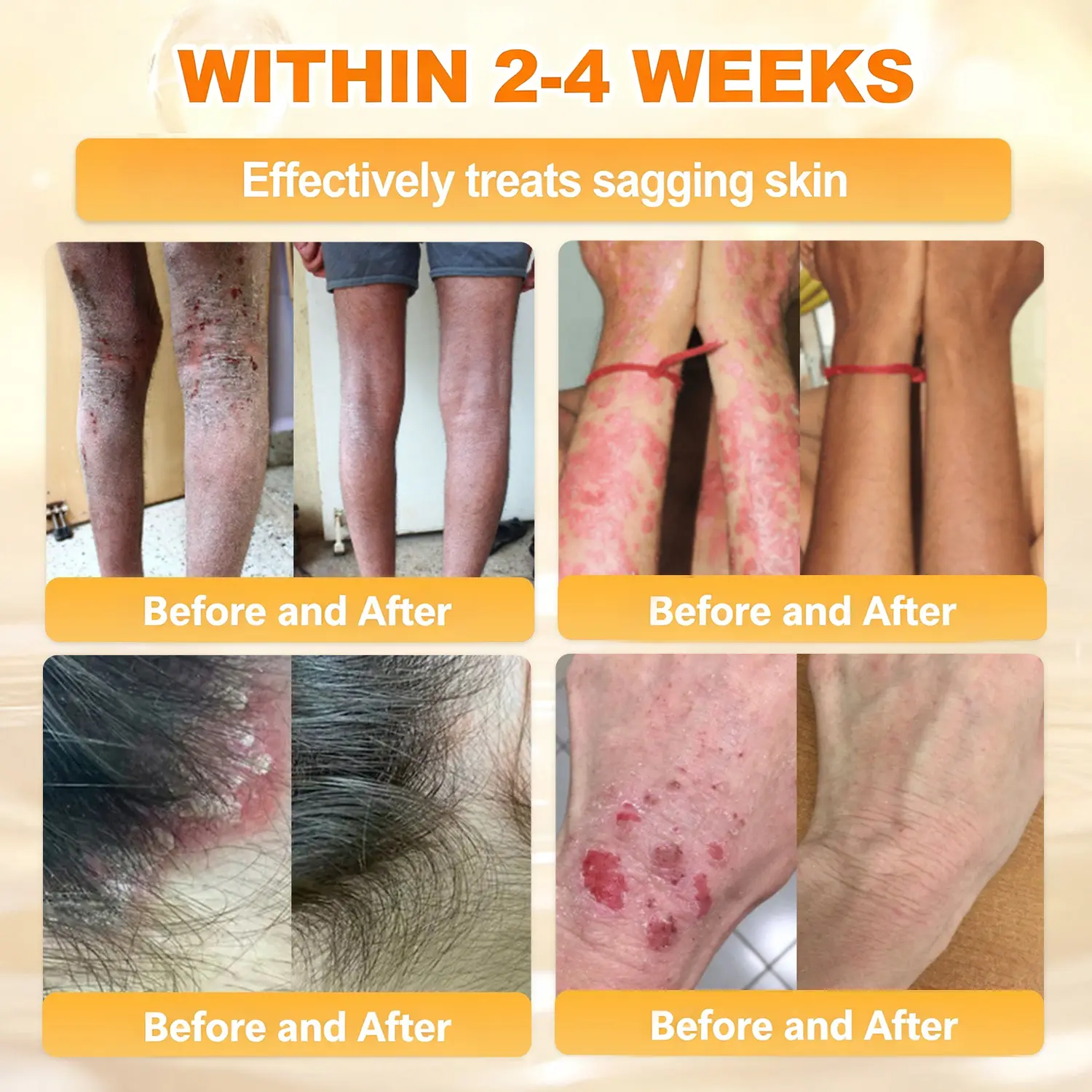 Bee Poison Skin Renewal Cream - Image 8