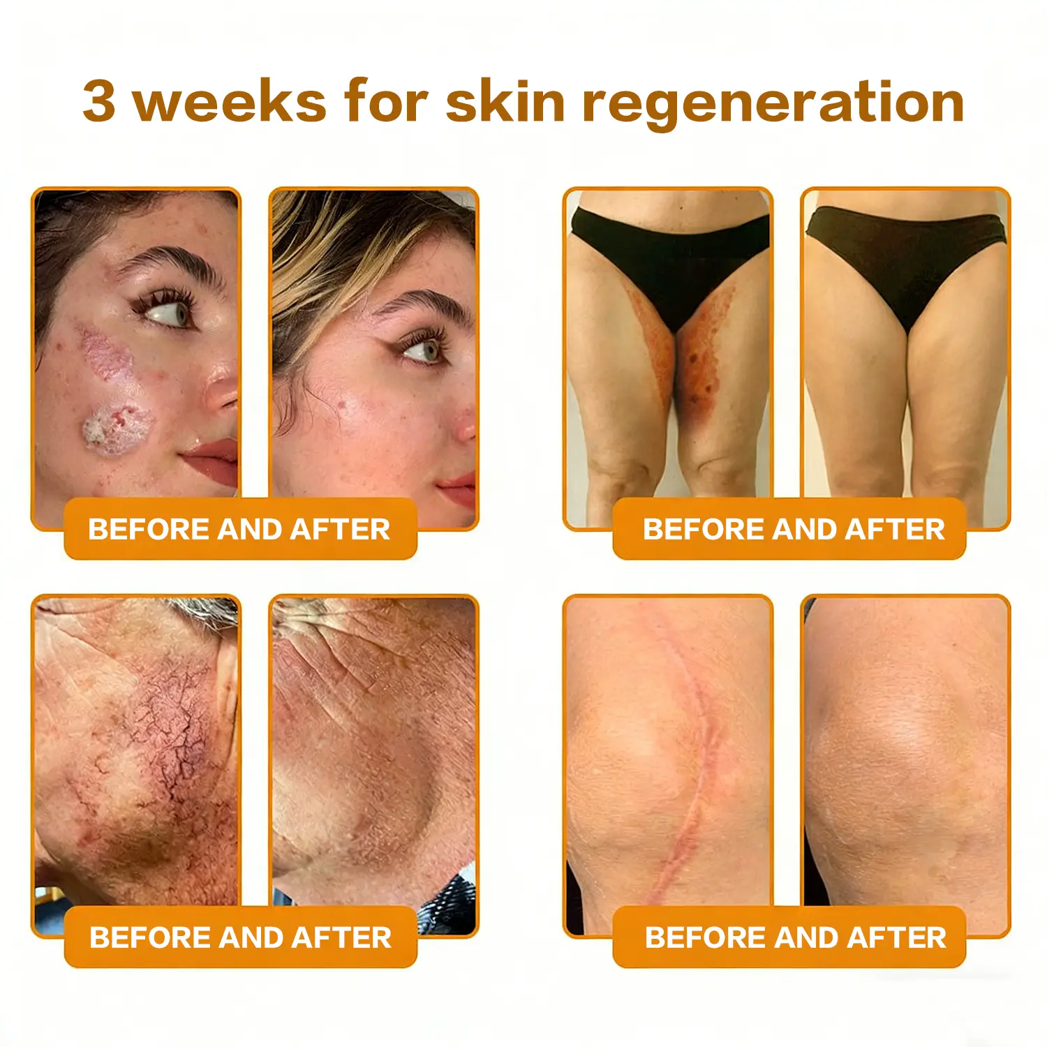 Bee Poison Skin Renewal Cream - Image 9