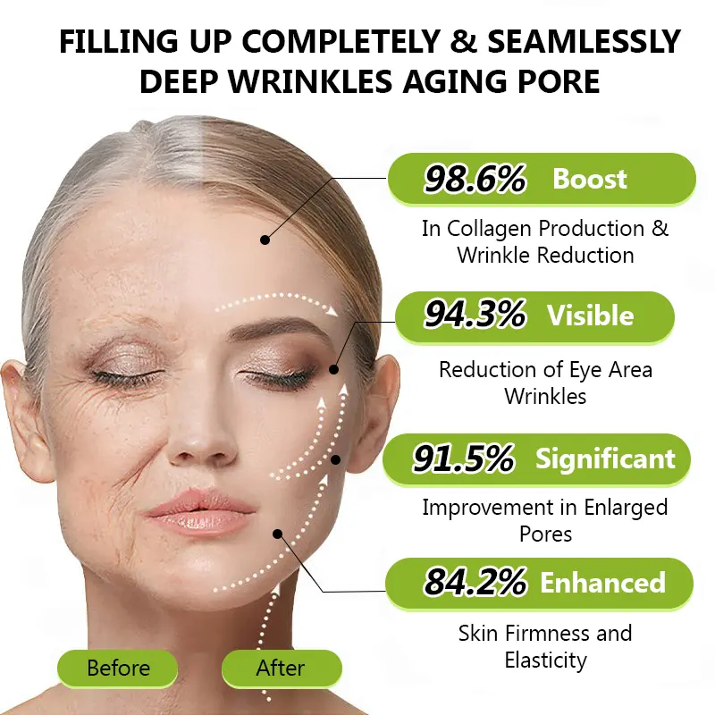 BOTOX & VITA A RETINOL SHOT Wrinkle Lift Tightening Cream - Image 12