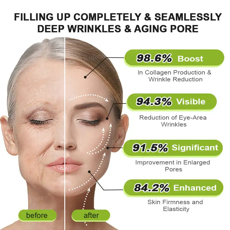 Botox & Vita-A Retinol Shot Wrinkle - Image 10