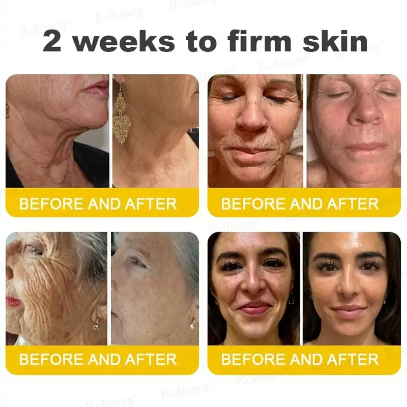 Botox & Vita A Retinol Shot Tightening Cream - Image 5