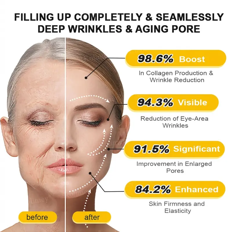 Botox & Vita A Retinol Shot Tightening Cream - Image 11