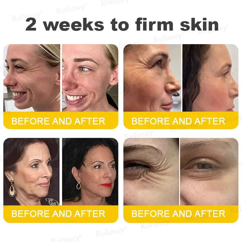Botox & Vita A Retinol Shot Tightening Cream - Image 4