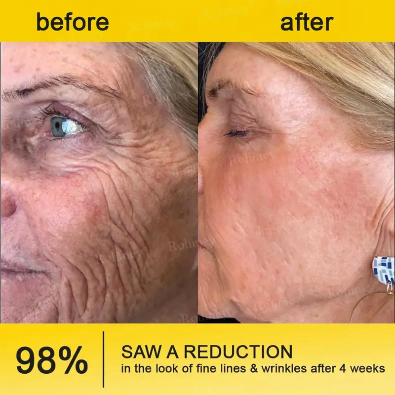 Botox & Vita A Retinol Shot Tightening Cream - Image 8