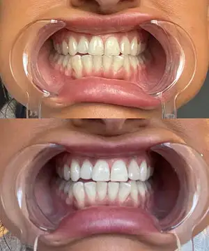 Stain Whitening Mouthwash - Image 6