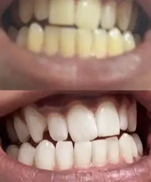 Stain Whitening Mouthwash - Image 8
