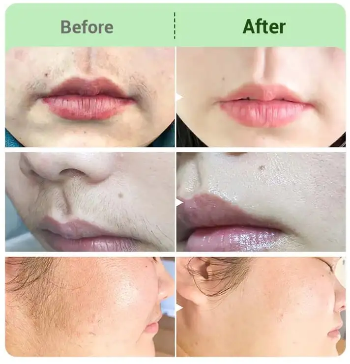 Hair Removal Cream for All Women & Men-Discounted Repeat Purchase - Image 4