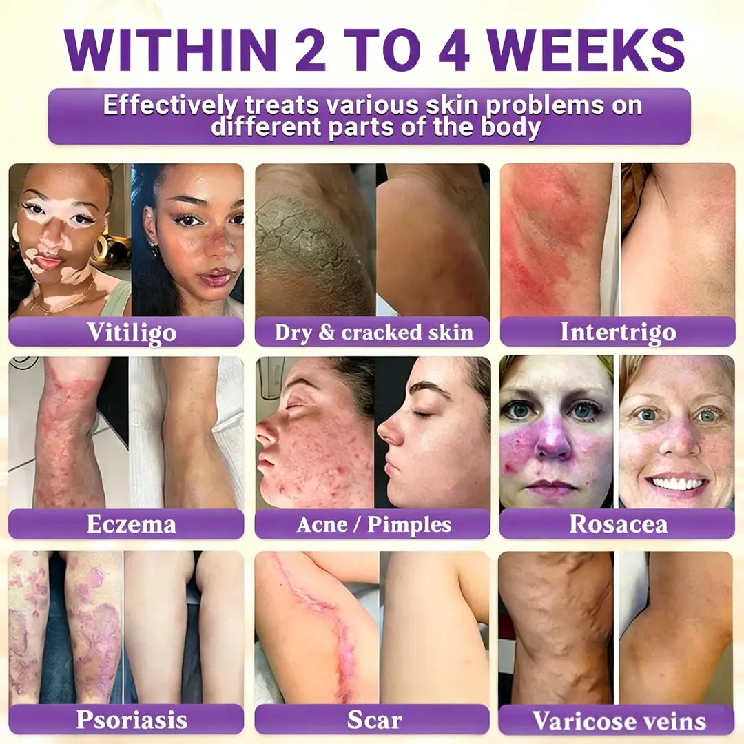 Biotin 10-in-1 Skin Restoration Cream - Image 2