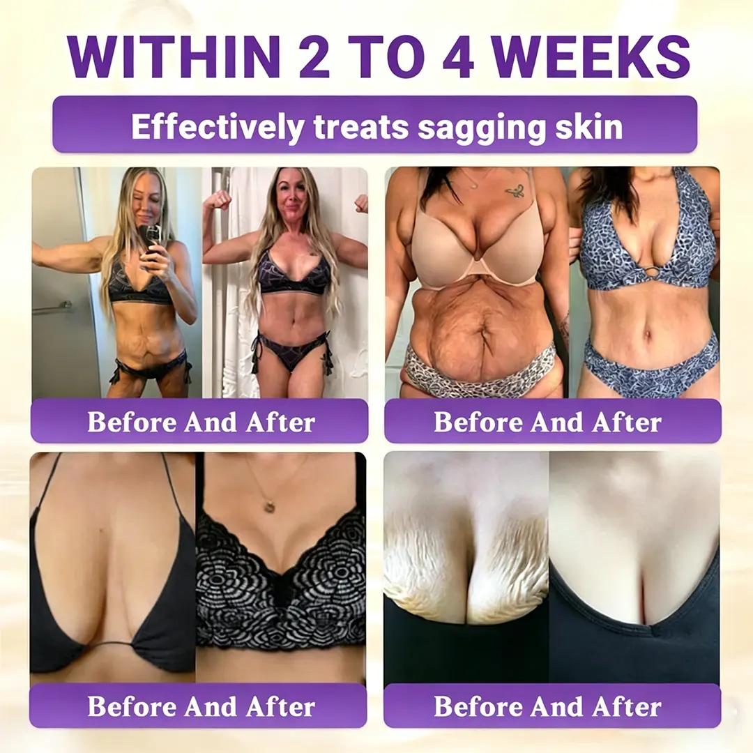 Biotin 10-in-1 Skin Restoration Cream - Image 3