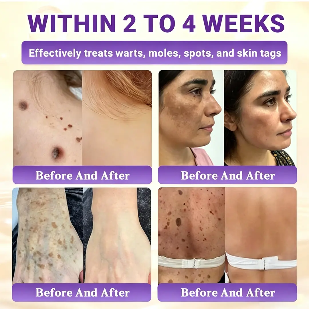 Biotin 10-in-1 Skin Restoration Cream - Image 5