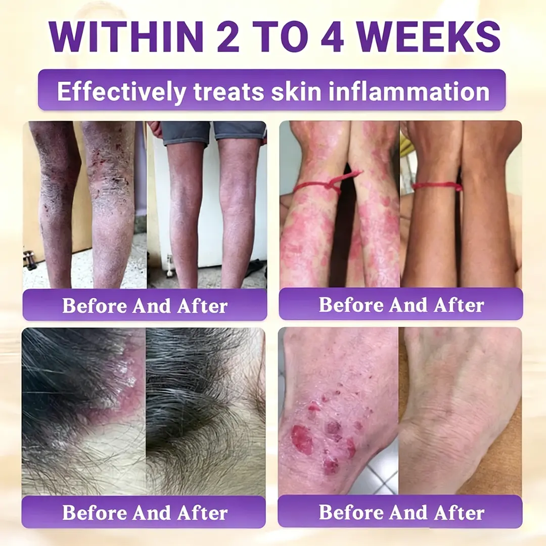 Biotin 10-in-1 Skin Restoration Cream - Image 6