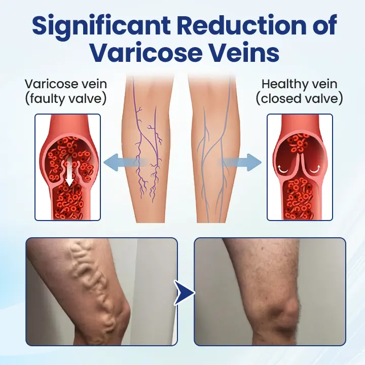 Deep Vein Repair Microneedle Patch - Image 6