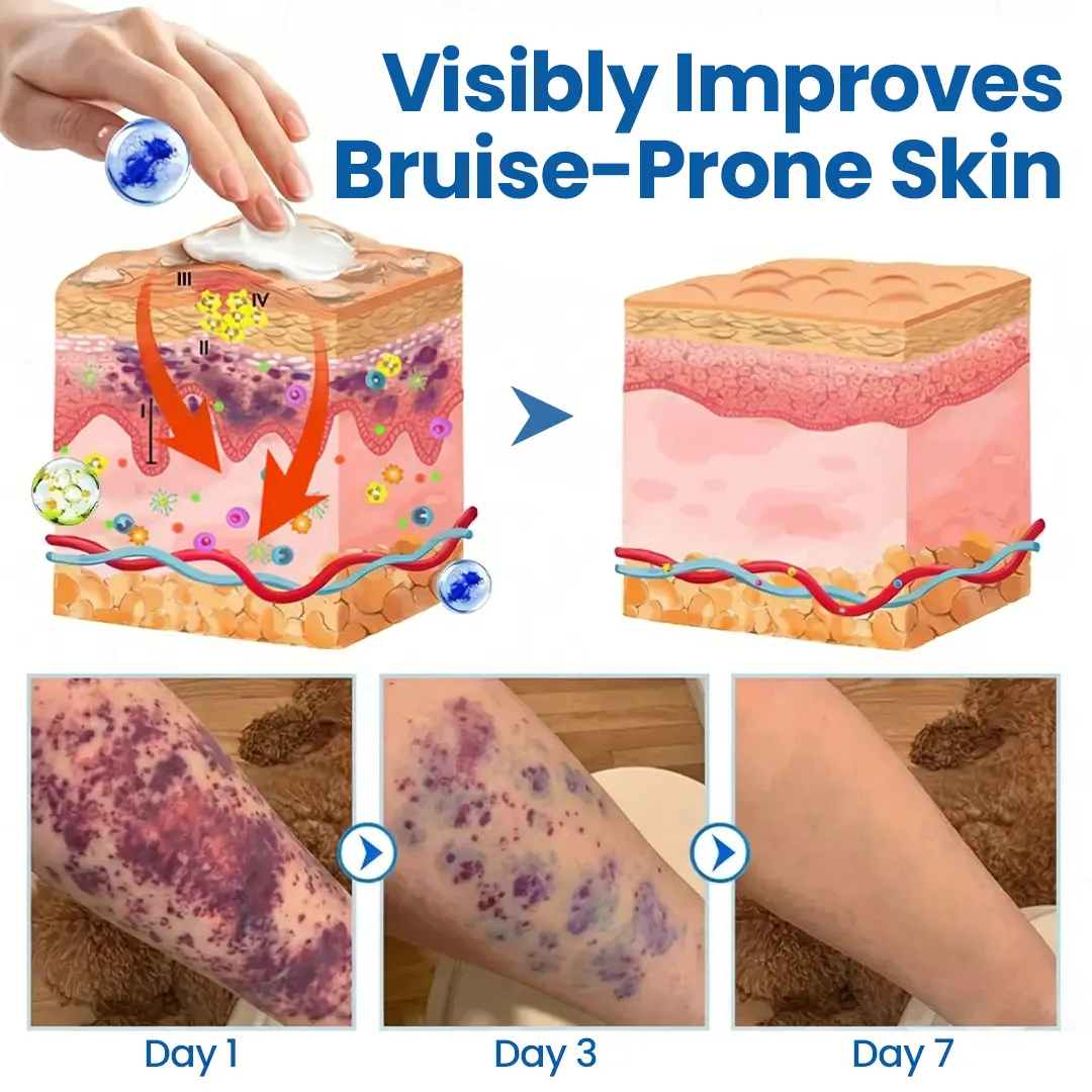Fragile Skin Repair Cream - Image 10