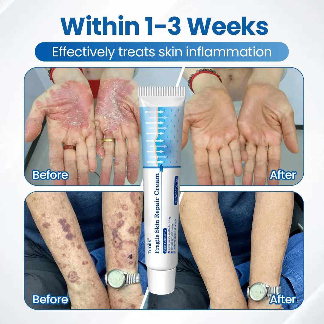 Fragile Skin Repair Cream - Image 2