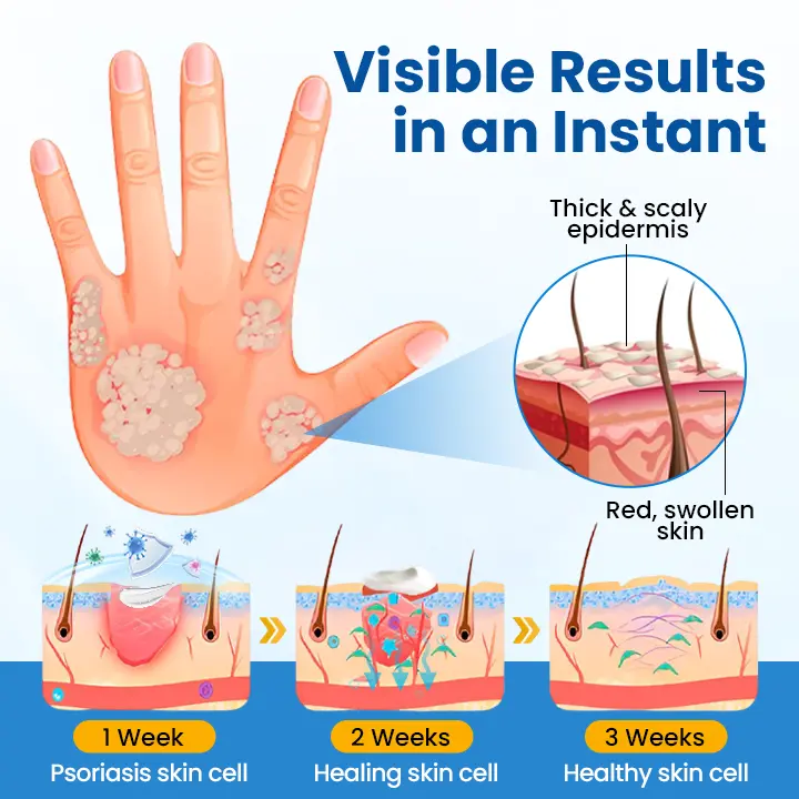 Fragile Skin Repair Cream - Image 9