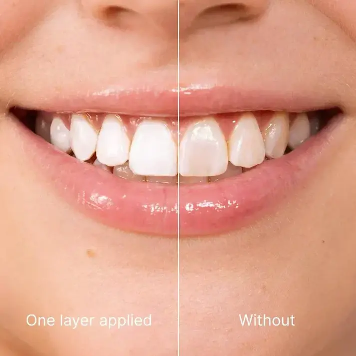 Tooth Polish - Instant Clean Smile! - Image 6