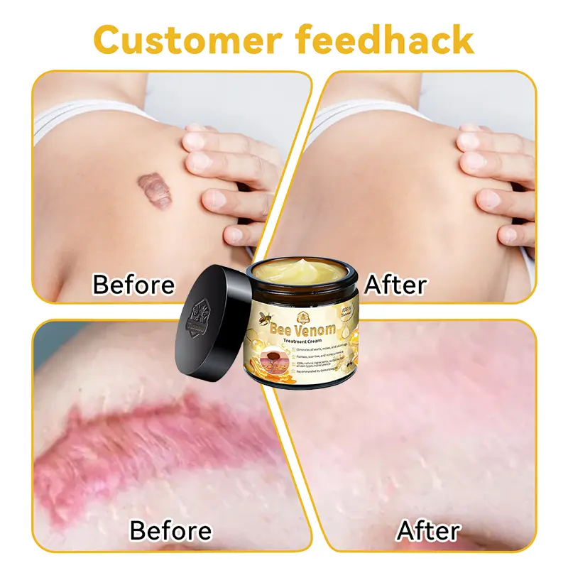 Bee Venom Therapy Cream - Image 5
