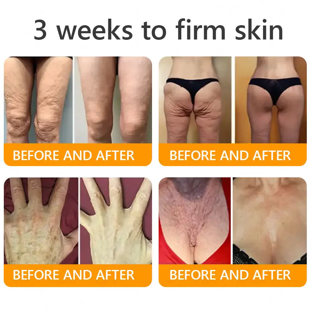 Bee Toxin Cream - Image 4