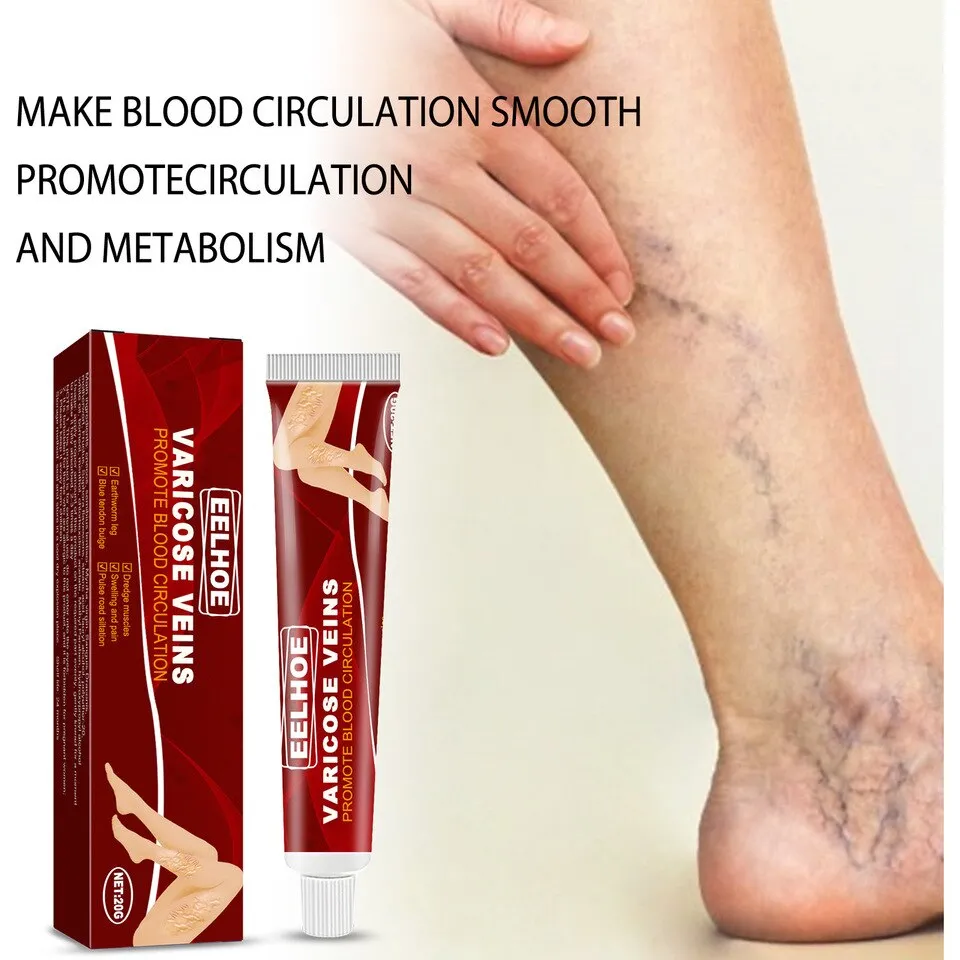 Varicose Veins Relief Cream - Image 3
