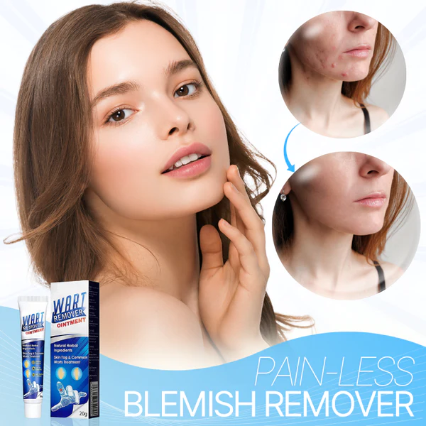 WART-LESS Immediate Blemish Removal Cream - Image 3