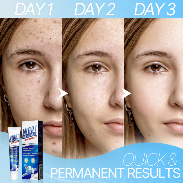 WART-LESS Immediate Blemish Removal Cream - Image 5