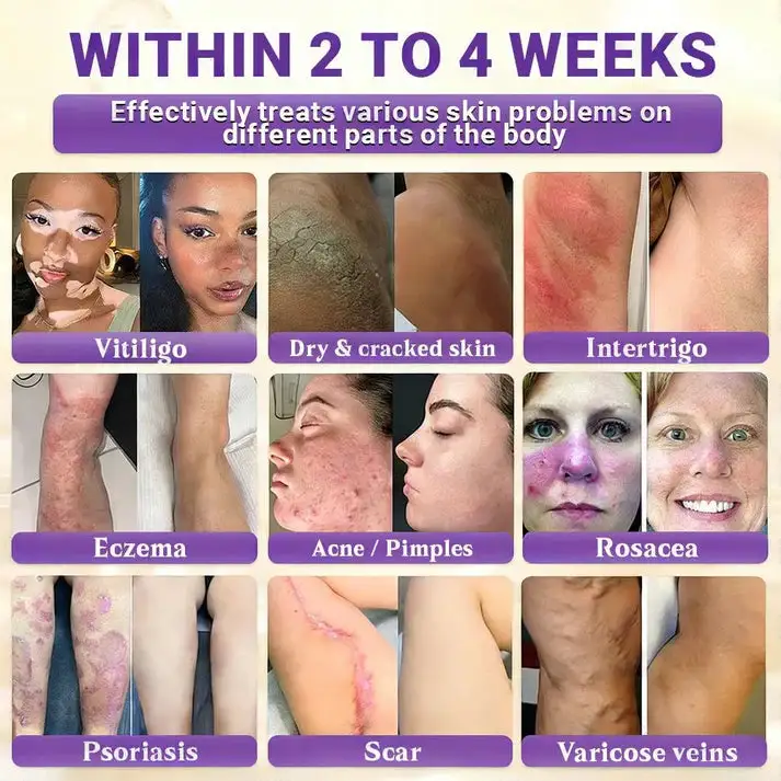 10-in-1 Skin Clear - Image 2