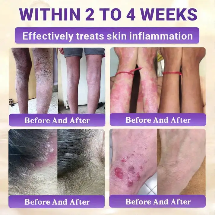 10-in-1 Skin Clear - Image 3