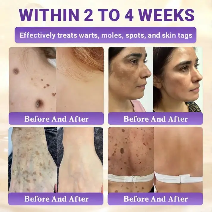 10-in-1 Skin Clear - Image 9