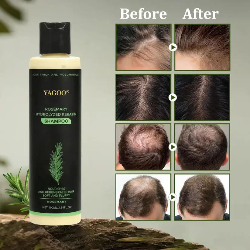 Hair growth shampoo - Image 4