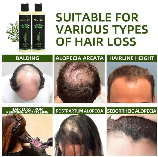 Hair growth shampoo - Image 7