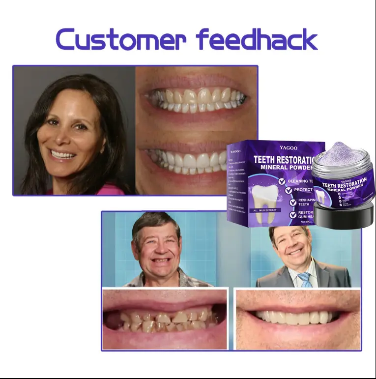 Teeth Restoration Mineral Powder - Image 8