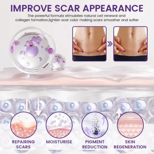 Viregensa Stem Cell Scar Gel - Image 3