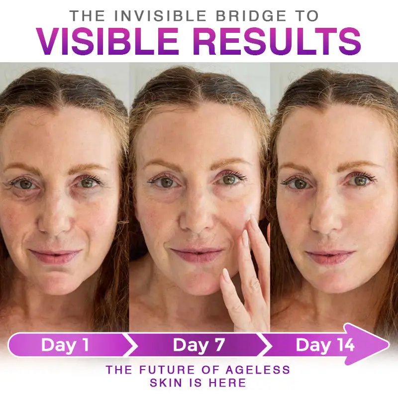 3-in-1 Microneedle Anti-Aging Patch - Image 6