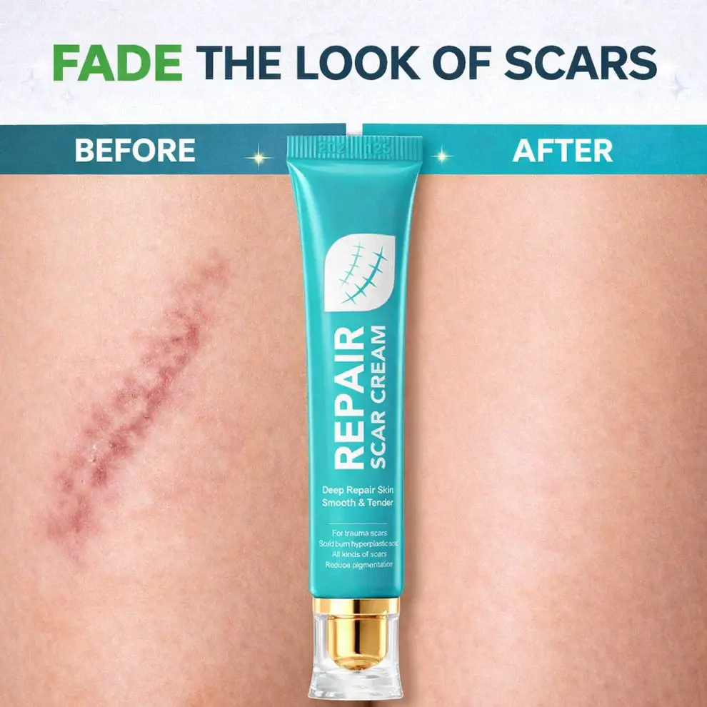 Alisanda Scar Repair Cream - Image 4