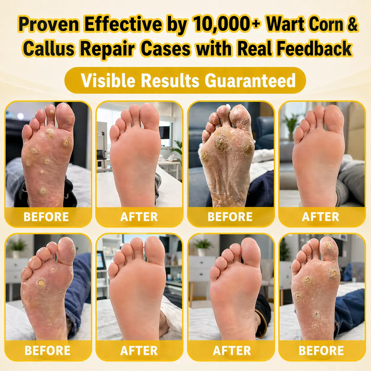 BEE POISON Corn & Callus Remover Cream - LOVILDS - Image 3