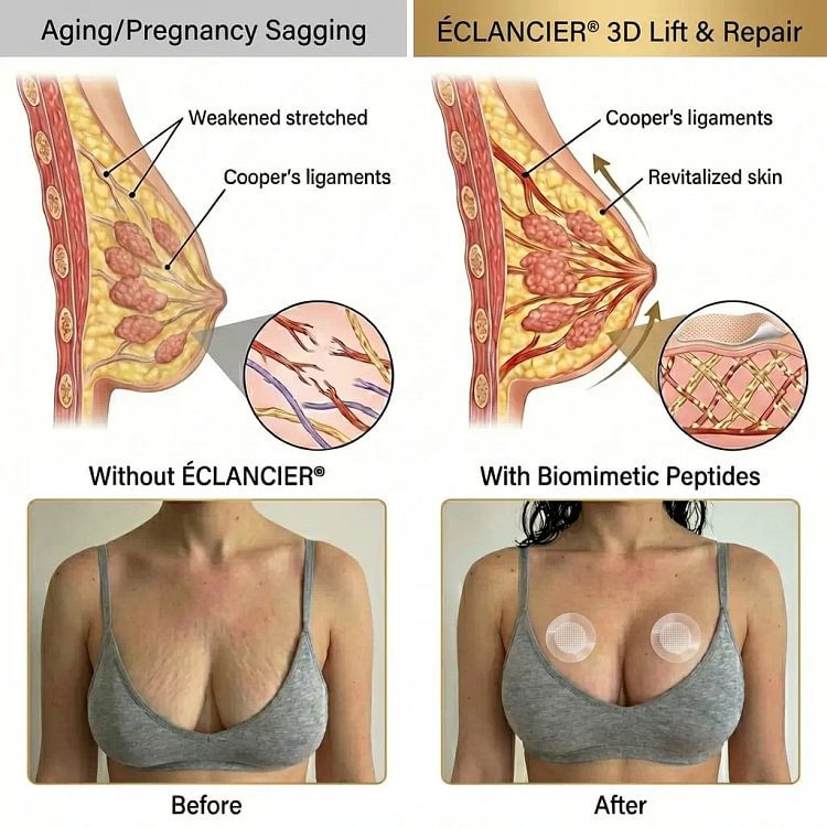 Targeted Breast Enhancement Advanced Nano Microneedle Patch - Image 3