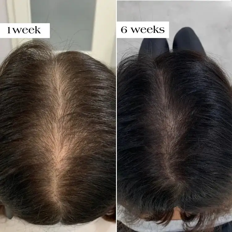 Organic Rosemary Hair Growth Shampoo - Image 6