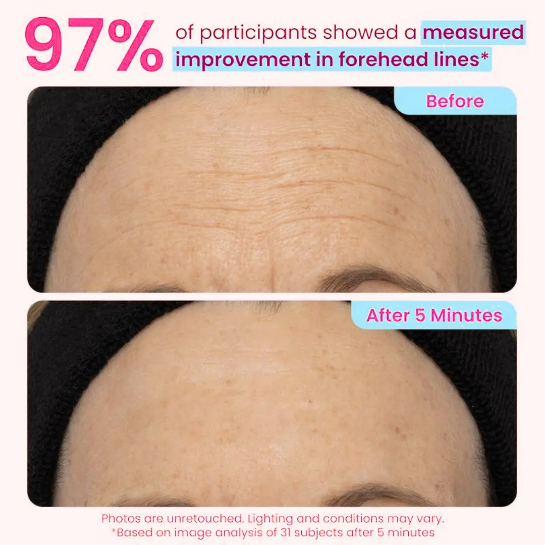 Instant Eye Tightening Gel - Image 6