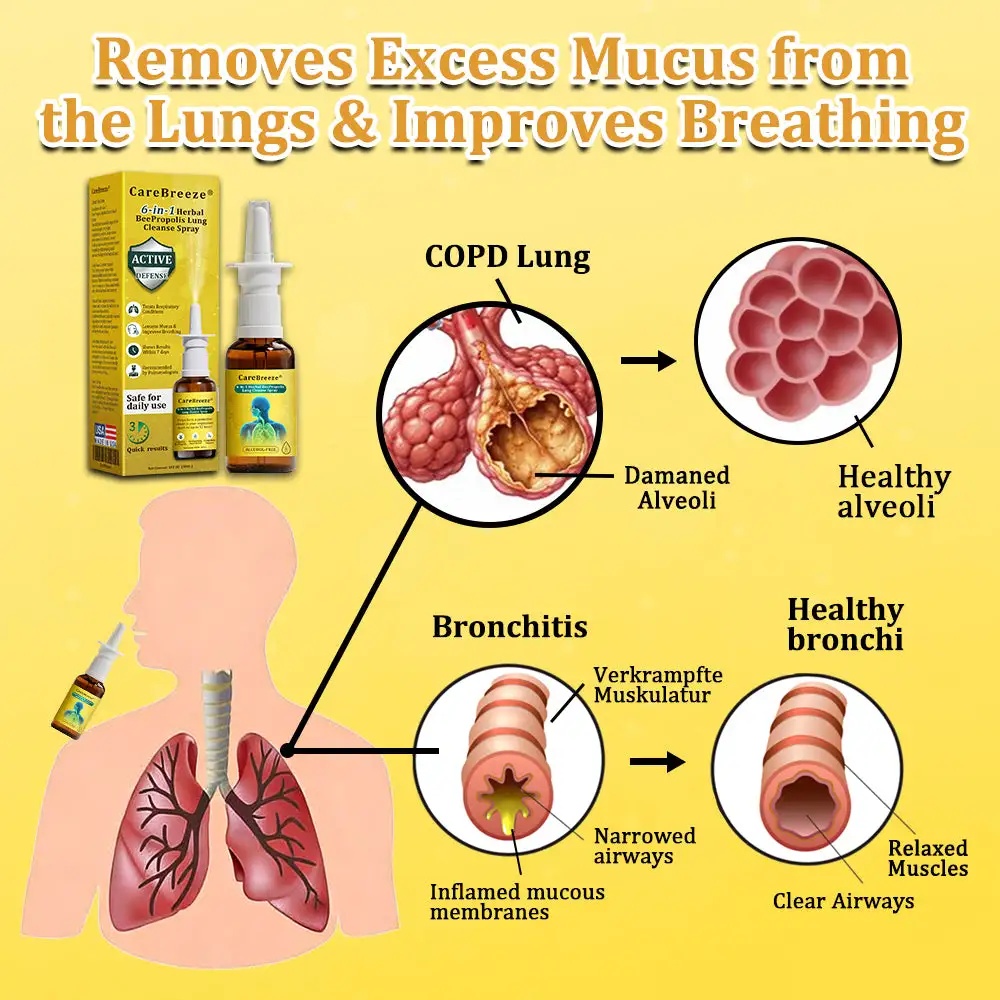6-in-1 Herbal BeePropolis Lung Cleanse Spray - Image 3