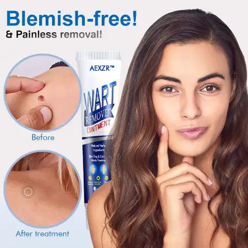 Wart Removal Ointment - Image 4