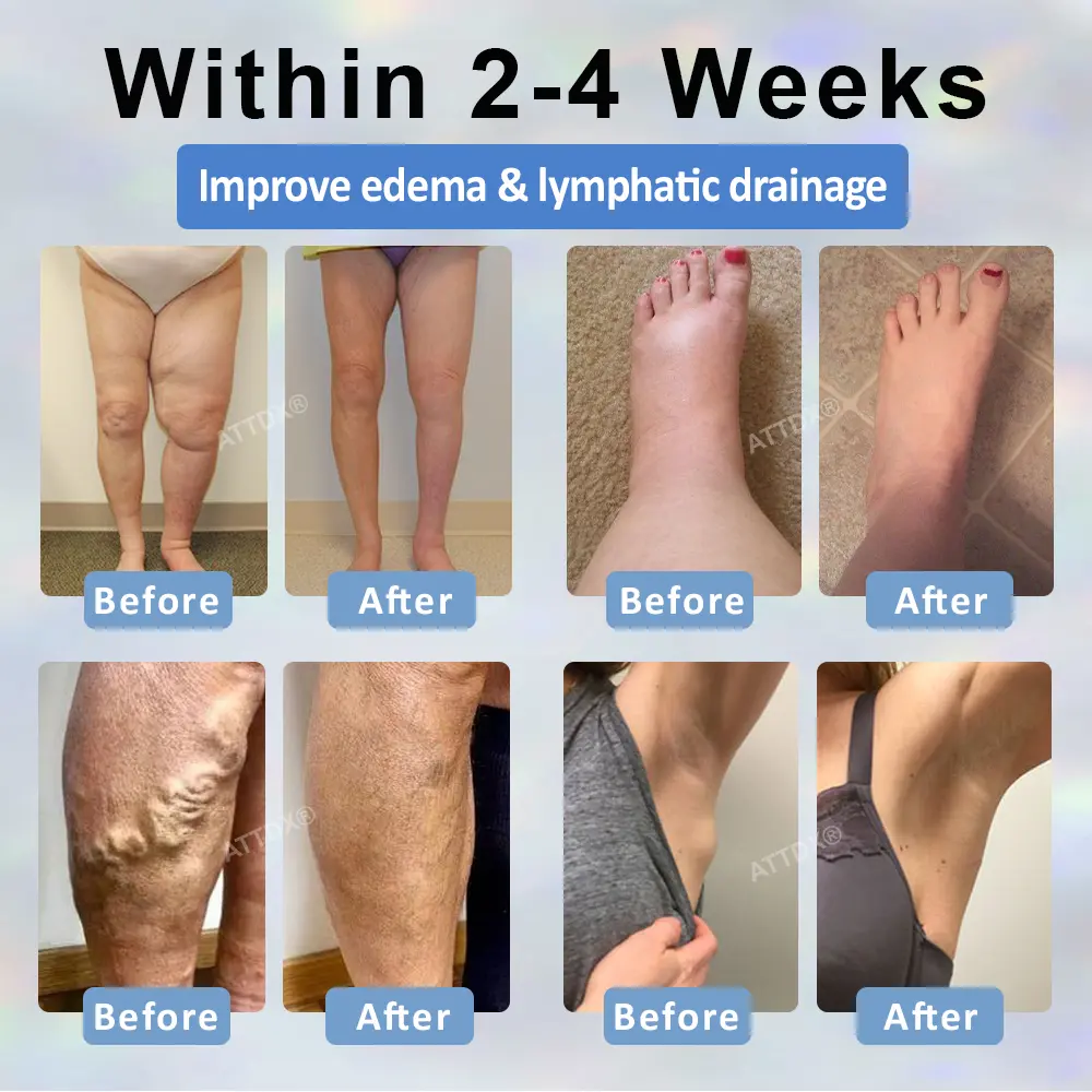 Black Cumin Edema Soothing Herbal Cream - Image 3