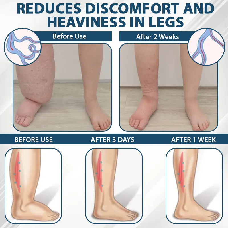 Black Cumin Edema Soothing Herbal Cream - Image 6