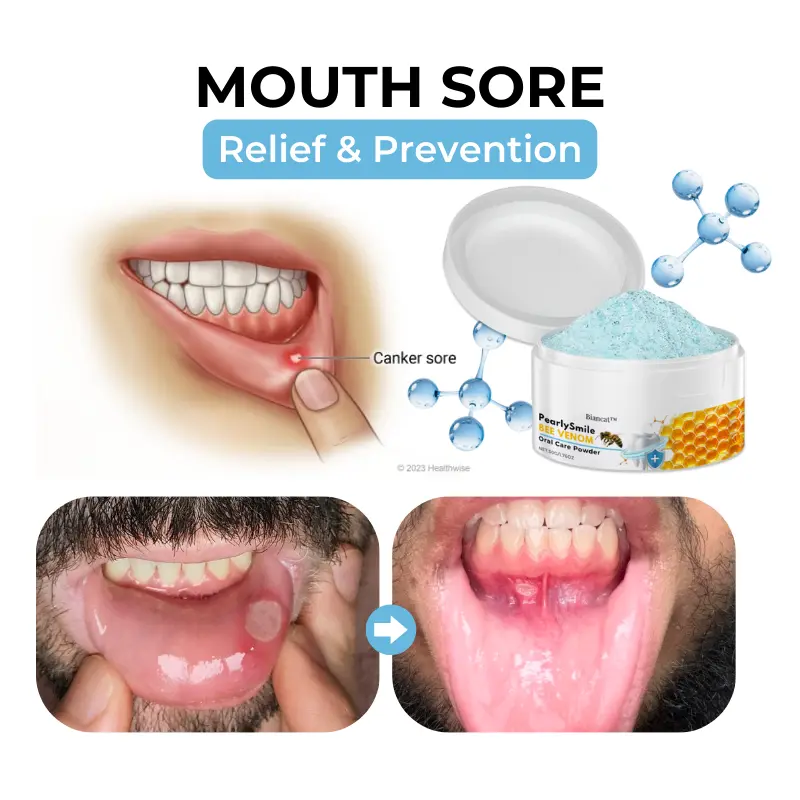 PearlySmile Bee Venom Oral Care Powder - Image 10