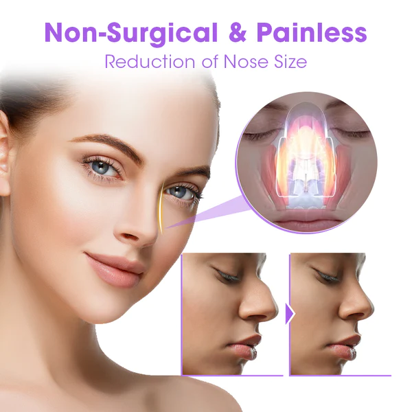 NosaNova Nose Sculpting Device - Image 2