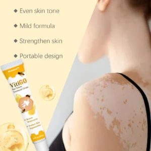 Alternative view of VitiGO Bee Venom Treatment Cream