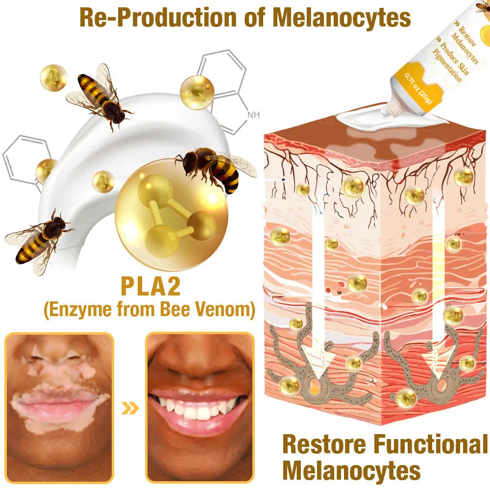 VitiGO Bee Venom Treatment Cream - Image 4