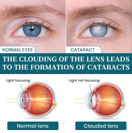 OptiFusion Nano Eye Drops Serum - Image 4